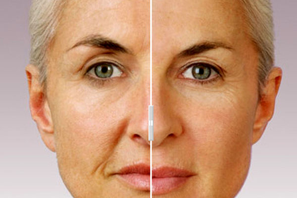 این ژل طبیعی پوست شما را جوان می کند