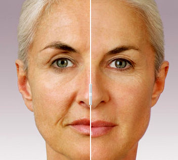 این ژل طبیعی پوست شما را جوان می کند