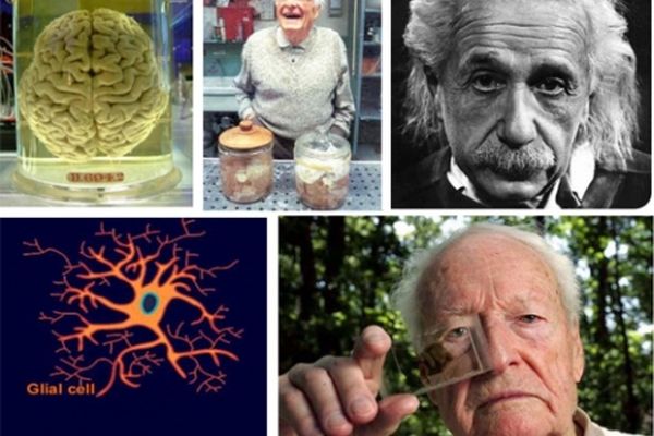 سرنوشت رازآلود مغز انیشتین/ چه کسی مغز انیشتین را به سرقت برد؟