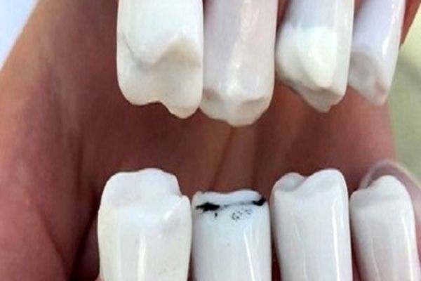 عجیب و غریب‌ترین مدل کاشت ناخن + عکس