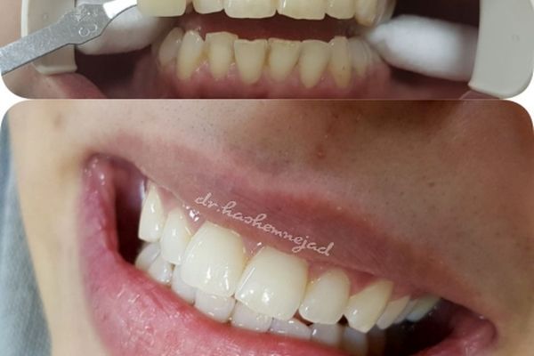 عید امسال را زیباتر بخندید.‼️