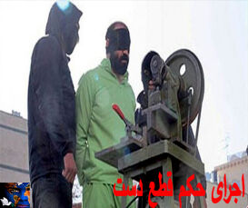 مجرم محکوم به قصاص قطع ید بخشیده شد