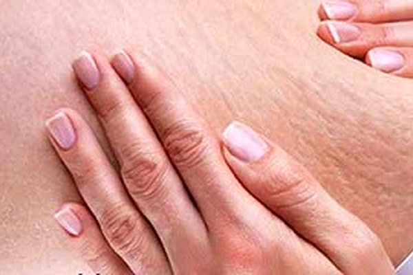 ترک های پوست را از بین ببرید