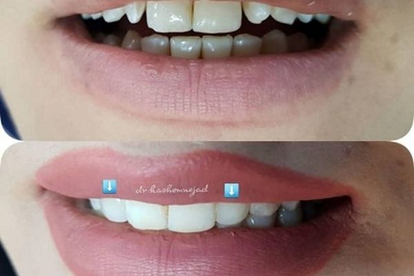 عید امسال را زیباتر بخندید.‼️