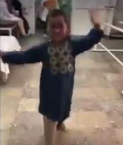 رقص و شادی کودک افغانستانی پس از دریافت پای مصنوعی