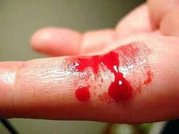 جوان مشهدی خود را آزار می داد / خون را دوست داشتم !