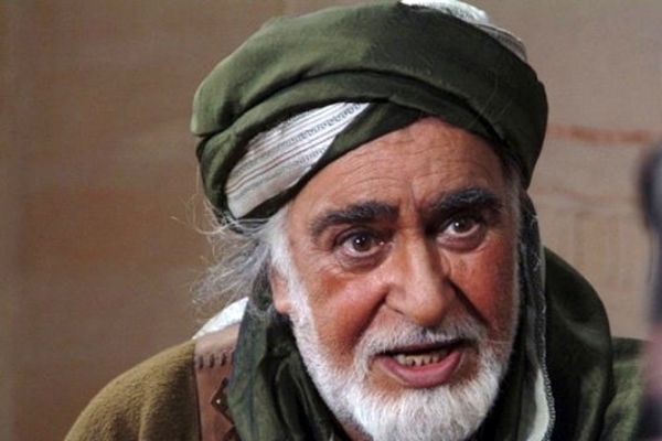 بازیگر معروف سینما و تلویزیون به کما رفت