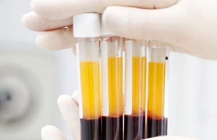 ۴۰۰ بهبود یافته کرونا در مشهد پلاسما اهدا کردند