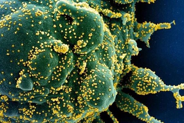 کروناویروس به سد خونی مغز آسیب می‌رساند