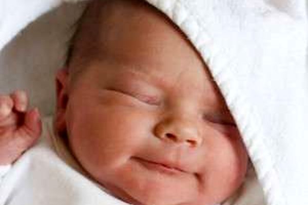 عوامل تشدید کننده زردی نوزاد