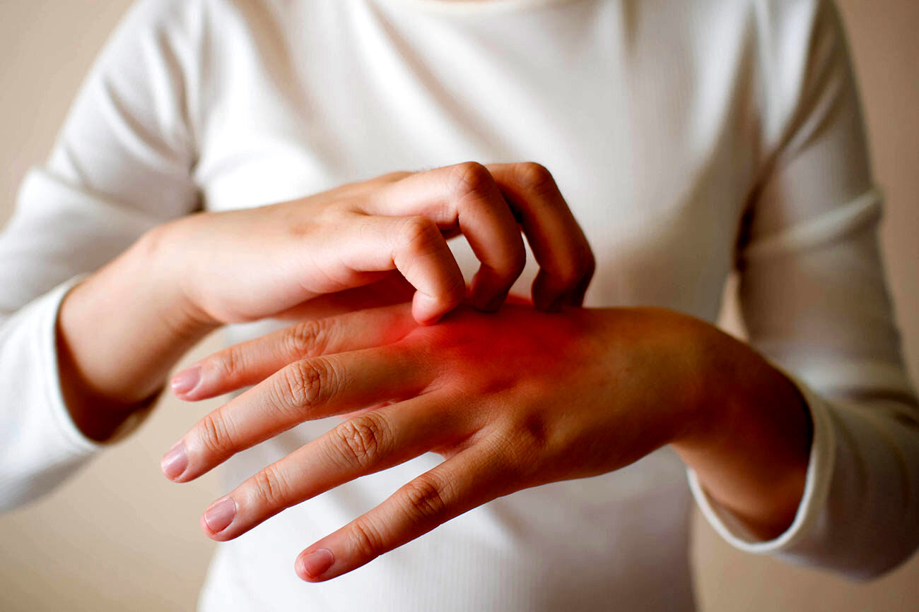 چگونه از تحریکات پوستی پیشگیری کنیم؟