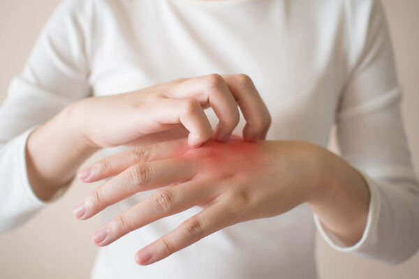 چگونه از تحریکات پوستی پیشگیری کنیم؟