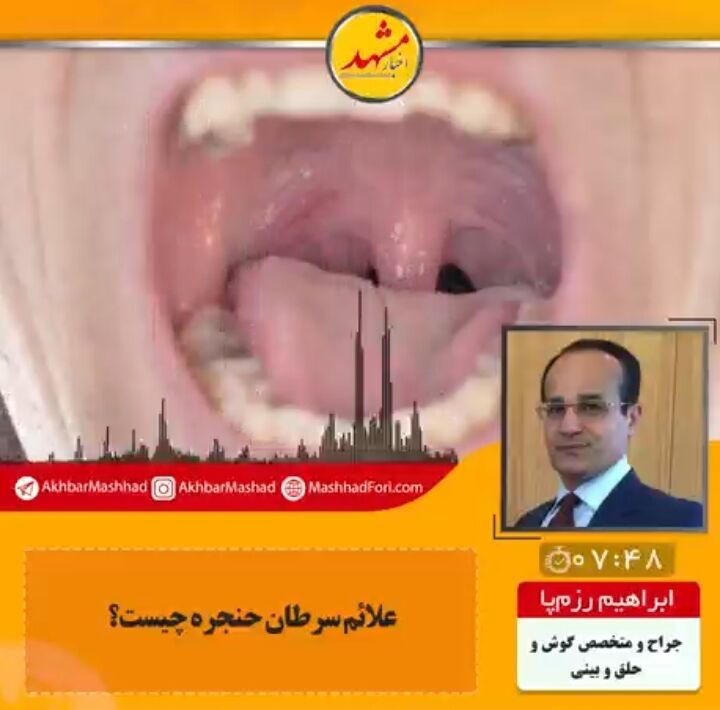 در صورت گرفتگی و تغییر صدا بیشتر از دوهفته، حنجره باید از نظر ابتلا به سرطان بررسی شود