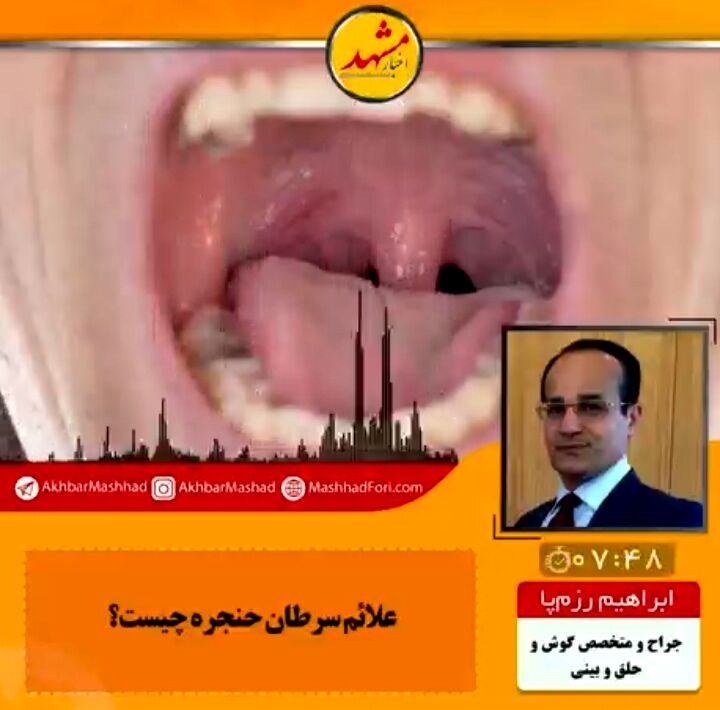 در صورت گرفتگی و تغییر صدا بیشتر از دوهفته، حنجره باید از نظر ابتلا به سرطان بررسی شود
