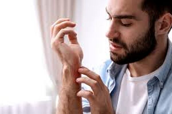 چرا بیماران کرونایی زونا می‌گیرند؟