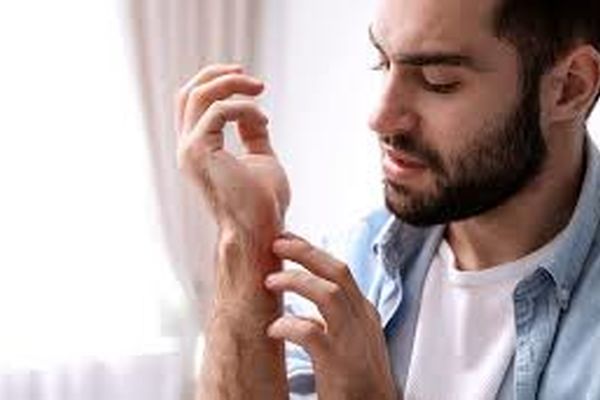 چرا بیماران کرونایی زونا می‌گیرند؟