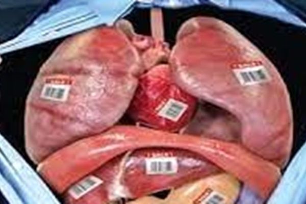 شایعه بیهوشی براثر نوشیدن دوغ در آرامستان بهشت رضا(ع) مشهد تکذیب شد/ قاچاق اعضای بدن چقدر واقعیت دارد؟