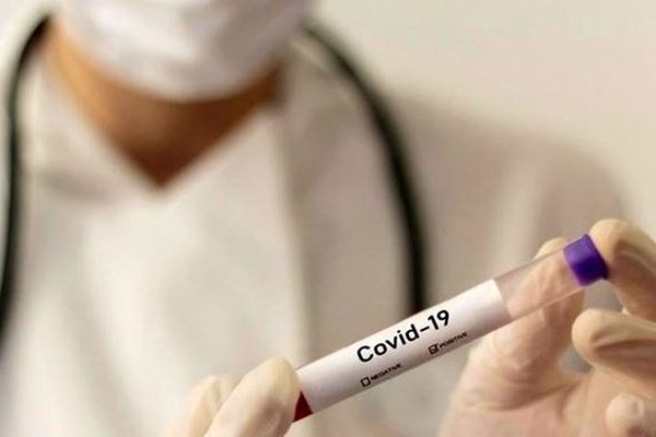 خدمت رسانی به بیماران کرونایی در مراکز پرازدحام تا ساعت ۲۱ ادامه دارد/ بیش از ۴۵ درصد تست‌های کرونا مثبت است