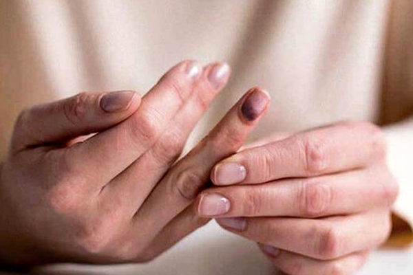 بی‌حسی و گزگز بدن برای چیست؟/ علت ۵ کمبود در بدن را بشناسید