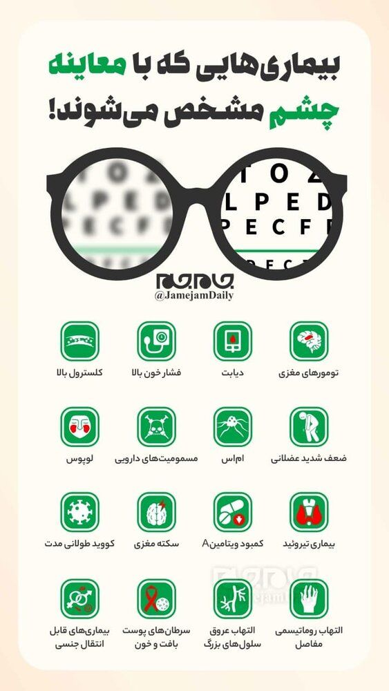 بیماری‌هایی که با معاینه چشم مشخص می‌شوند!/ اینفوگرافیک