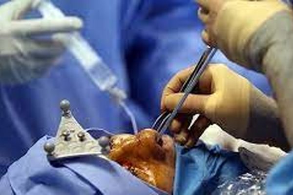 علت مرگ افراد در جریان و بعد از جراحی پلاستیک چیست؟