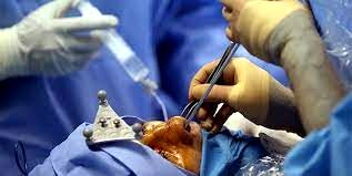 علت مرگ افراد در جریان و بعد از جراحی پلاستیک چیست؟
