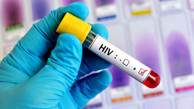 ۳۰میلیون نفر در دنیا مبتلا به ویروس HIV هستند