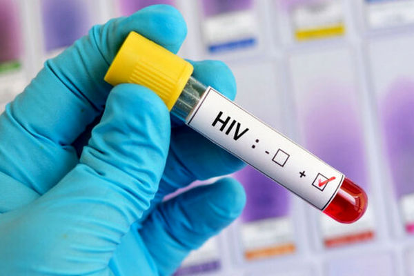 ۳۰میلیون نفر در دنیا مبتلا به ویروس HIV هستند
