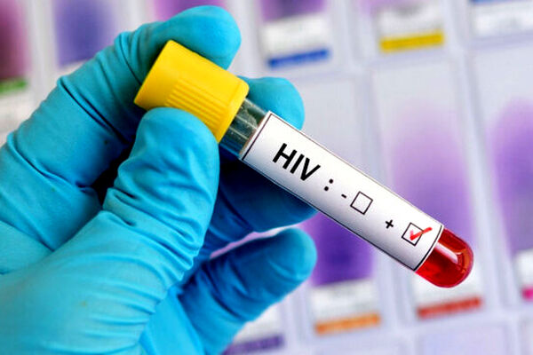 ۳۰میلیون نفر در دنیا مبتلا به ویروس HIV هستند