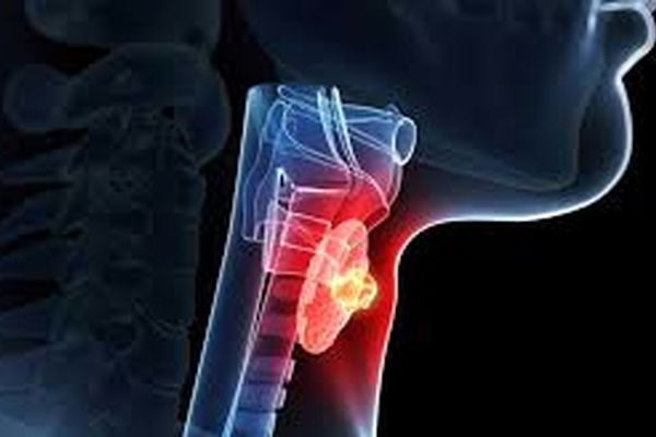 اگر کم کاری تیروئید دارید این غذاها را نخورید