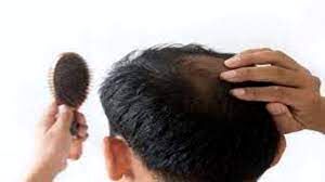 ریزش مو را با این 4 روغن درمان کنید