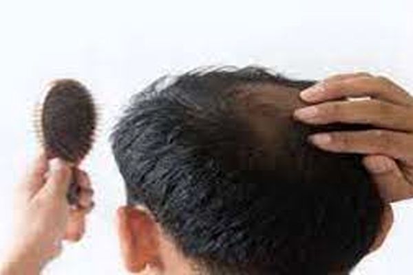 ریزش مو را با این 4 روغن درمان کنید