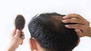 ریزش مو را با این 4 روغن درمان کنید