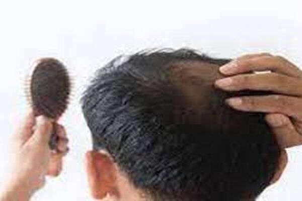 ریزش مو را با این 4 روغن درمان کنید