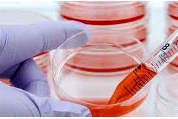 برای نخستین بار اهدای سلول‌های بنیادی با روش‌های نوین در خراسان رضوی