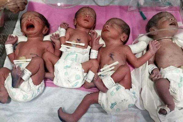 زن جوان گنابادی 4 قلو پسر به دنیا آورد