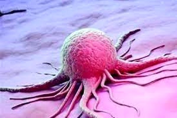 علل سرطان معده و علائم اصلی آن را بدانید