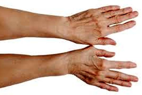 چند راهکار ساده برای مقابله با درد آرتروز را امتحان کنید