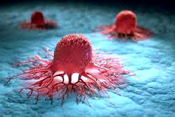 تغییر شیوع سرطان در ایران/2 سرطان رایج مردان و زنان را بشناسید