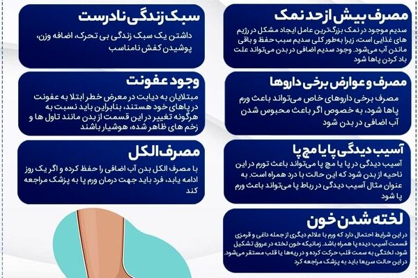 7 علت ورم پا را بدانید!
