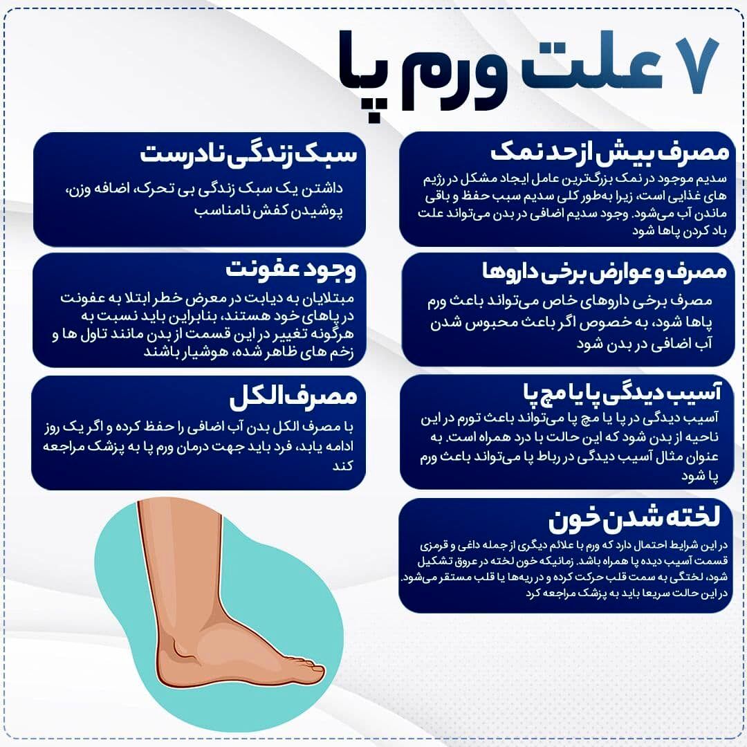 7 علت ورم پا را بدانید!