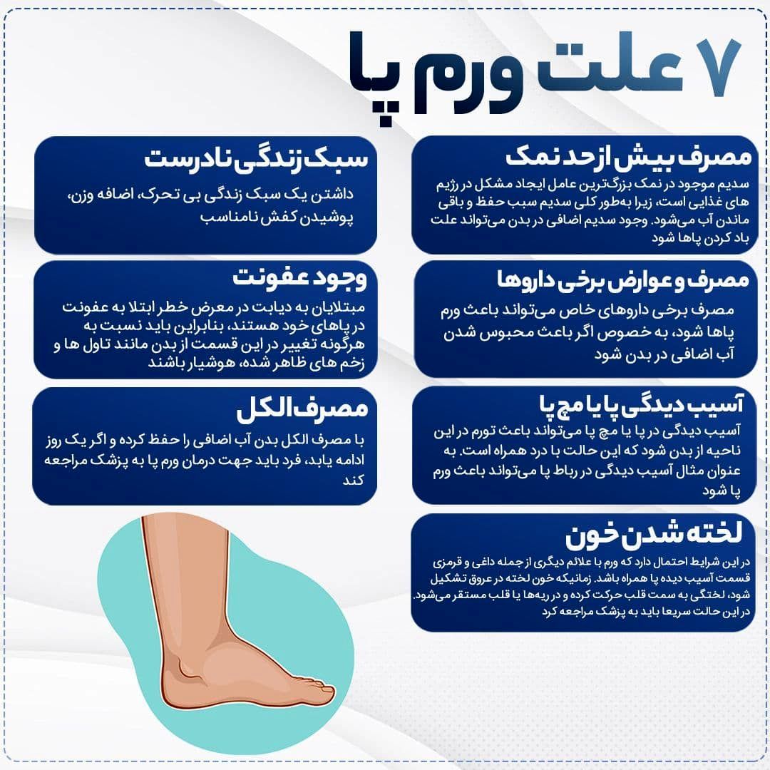 7 علت ورم پا را بدانید!