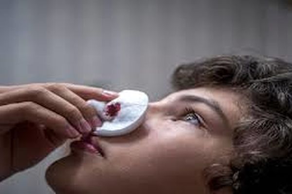 کرونا به تنهایی عامل خون‌ریزی نیست/عدم گزارش بیماری زامبی در ایران