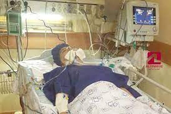 زمان حضور بیمار مبتلا به سکته مغزی نباید با تاخیر همراه باشد