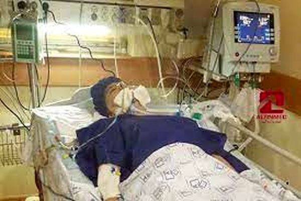 زمان حضور بیمار مبتلا به سکته مغزی نباید با تاخیر همراه باشد