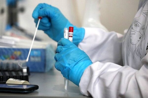 نتایج ۳۰ درصد آزمایش‌های کرونا در خراسان رضوی مثبت است