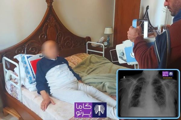 رادیولوژی در منزل مشهد گاما پرتو