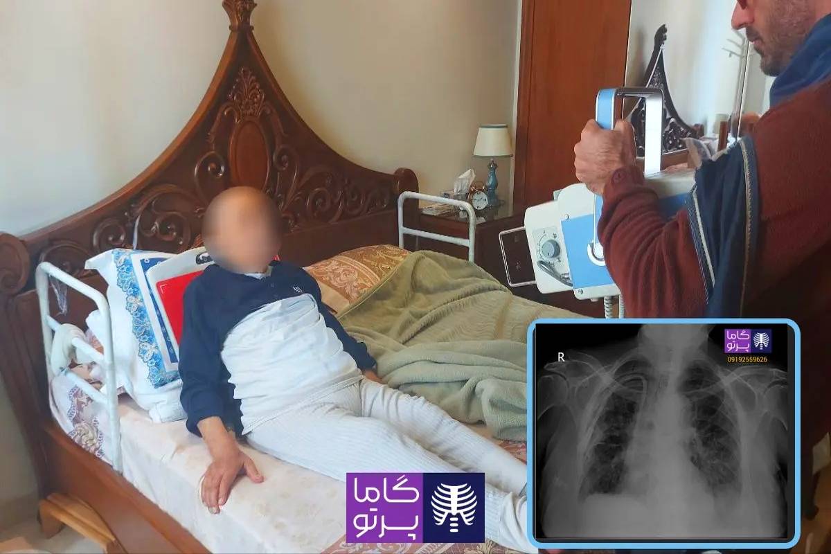 رادیولوژی در منزل مشهد گاما پرتو