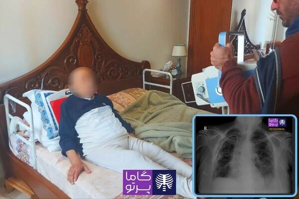رادیولوژی در منزل مشهد گاما پرتو