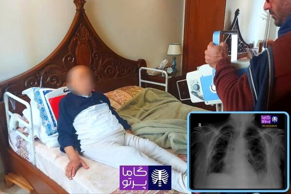 رادیولوژی در منزل مشهد گاما پرتو